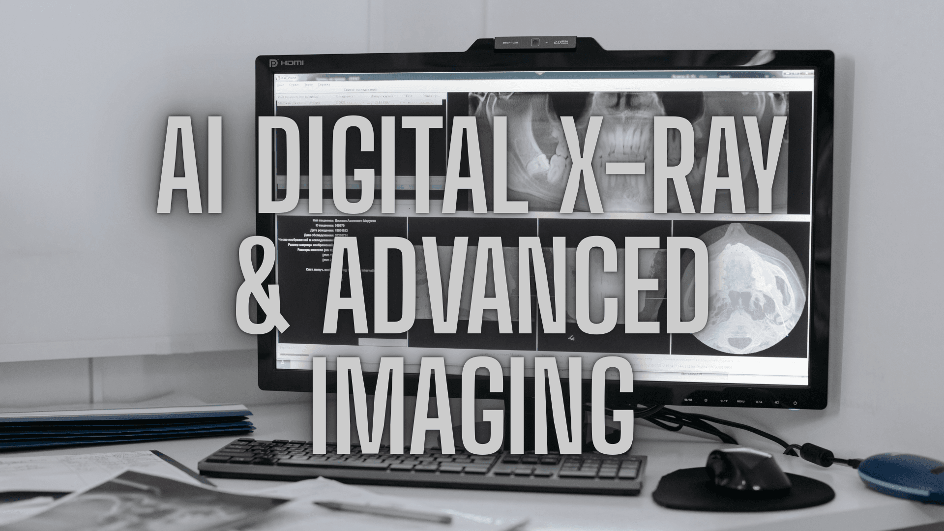 Digital X-Ray